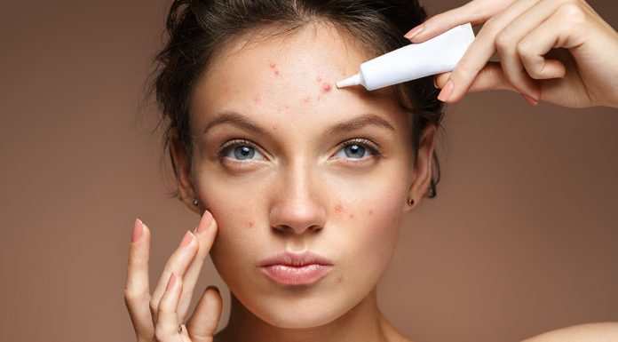 getting rid of acne scars