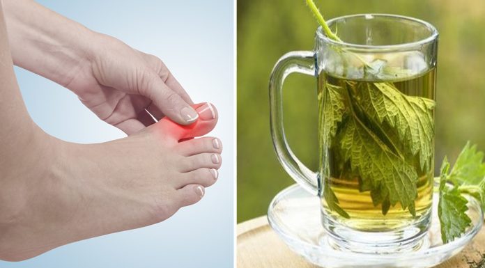 natural remedies gout