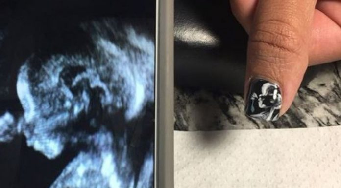 ultrasounds on nails