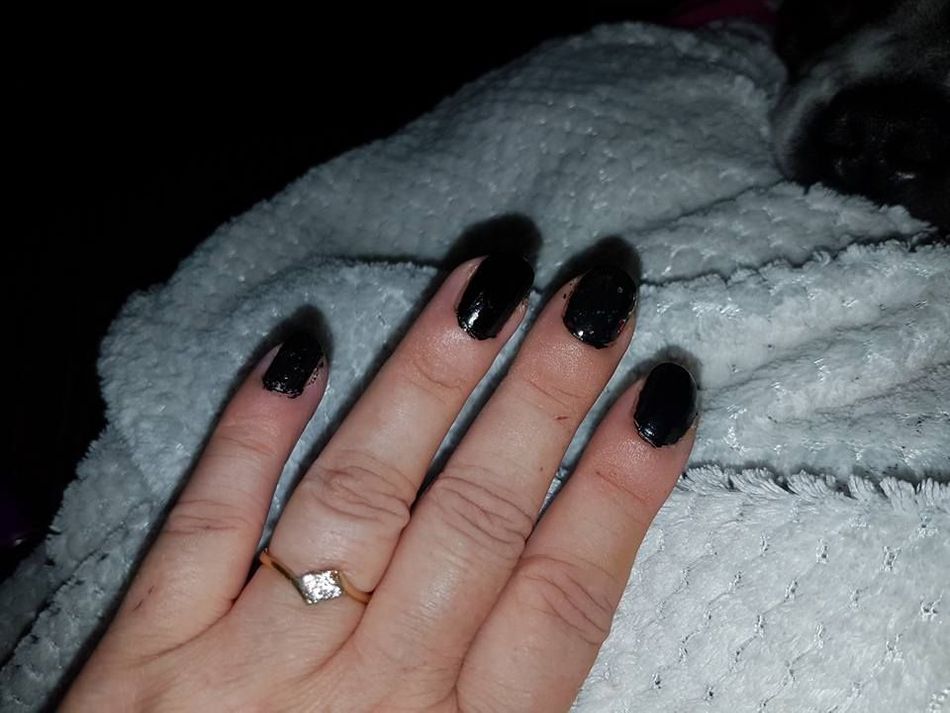 Woman Discovers She Has Cancer After Posting Picture Of Her Nails
