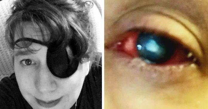 mom blind contact lenses parasite