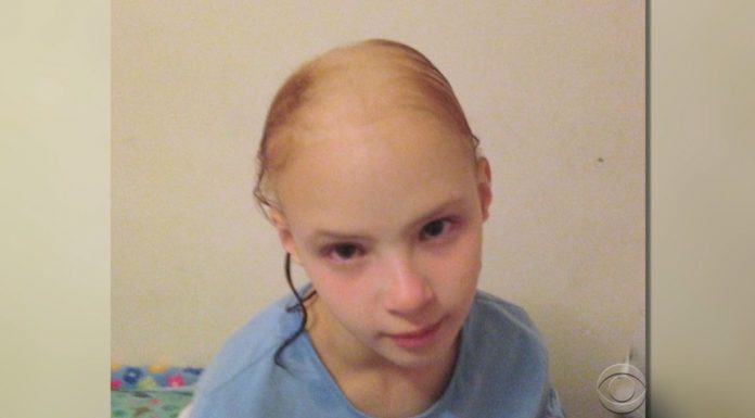 girl loses hair product